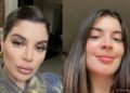 Gkay retira o preenchimento labial e recebe elogios