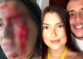 Suspeito de agredir namorada em Teresina é filho de delegado