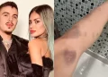 Tati Zaqui denuncia Thomaz Costa à polícia por agressões, ameaças e abusos