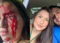 Estudante de Direito denuncia que foi agredida por namorado em Teresina