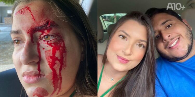 Estudante de Direito denuncia que foi agredida por namorado em Teresina