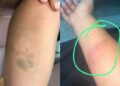 Ex-namorada denuncia dentista por agressão em Teresina
