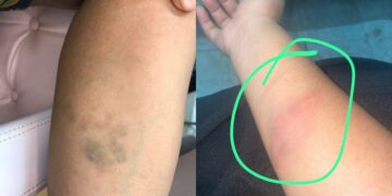 Ex-namorada denuncia dentista por agressão em Teresina