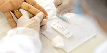 Anvisa deixa de exigir vacinação ou teste de covid para viajantes