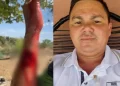 Assessor de prefeitura é atacado por piranha durante pescaria na cidade de Campo Maior