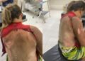 Marido é preso por atear fogo na esposa enquanto ela dormia no Sul do Estado do Piauí