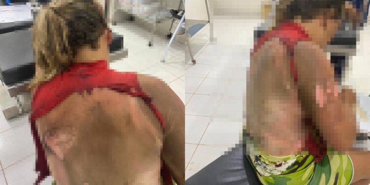 Marido é preso por atear fogo na esposa enquanto ela dormia no Sul do Estado do Piauí