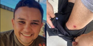 Pastor é surpreendido e baleado por motociclista na zona Leste de Teresina