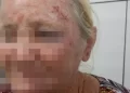 Idosa de 63 Anos esfaqueia assaltante após Invasão em sua casa no Piauí