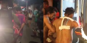 Homem é esfaqueado após briga com irmão na zona norte de Teresina