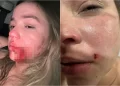 Síndico de condomínio é acusado de agredir modelo na zona leste de Teresina