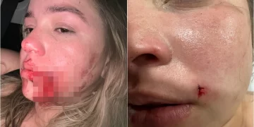 Síndico de condomínio é acusado de agredir modelo na zona leste de Teresina