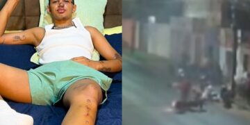 Influencer freitense que sofreu grave acidente recebe alta e se encontra em recuperação