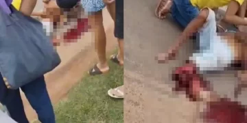 Idoso é atropelado por uma motocicleta e tem a perna esmagada no interior do Piauí