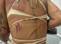 Mulher trans é agredida a pauladas ao sair de bar com namorado no Rio de Janeiro