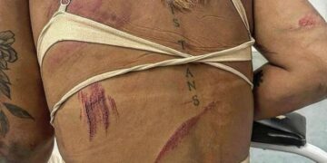 Mulher trans é agredida a pauladas ao sair de bar com namorado no Rio de Janeiro