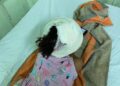 Criança de quatro anos fica ferida após ser atacada por cachorro no Piauí