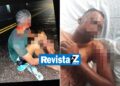 Homem é hospitalizado depois de ser atacado por vários cachorros, em Batalha