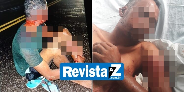 Homem é hospitalizado depois de ser atacado por vários cachorros, em Batalha