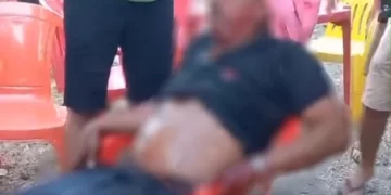 Segurança é esfaqueado por três pessoas durante festa em Campo Maior