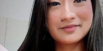 Família pede doações para mulher atingida por avião do médico Jacinto Lay