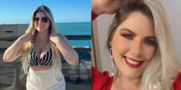 Empresária de 24 anos morre após fazer seis cirurgias plásticas ao mesmo tempo