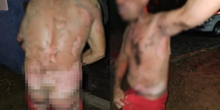 Mulher é presa por tentativa de homicídio após usar cachaça para atear fogo no companheiro no Piauí