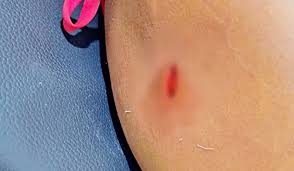 Padrasto é preso após atacar enteada com faca durante briga no interior do Piauí