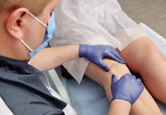 Prefeitura de Lagoa Alegre promove mutirão de cirurgia de varizes para a população