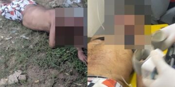 Homem é agredido a golpes de madeira e pedra por vizinho no interior do Piauí