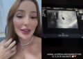 Mulher que diz ter se relacionado com Neymar mostra ultrassom de grávida