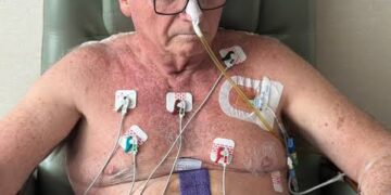 Bolsonaro tem boa evolução clínica, mas permanece na UTI sem previsão de alta