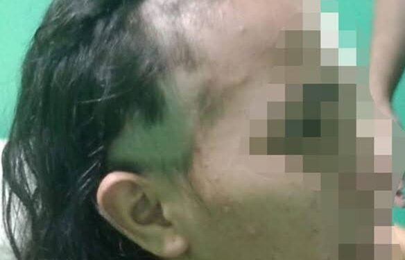 Mulher forja agressão e raspa o próprio cabelo para incriminar companheiro em Matias Olímpio