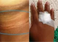 Criança fica ferida após ser atingida por linha de pipa no interior do Piauí