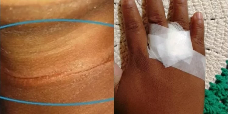 Criança fica ferida após ser atingida por linha de pipa no interior do Piauí