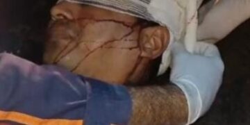 Pai e filha sofrem acidente ao colidir motocicleta com animal na PI-113, em José de Freitas