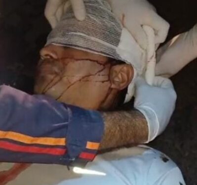 Pai e filha sofrem acidente ao colidir motocicleta com animal na PI-113, em José de Freitas