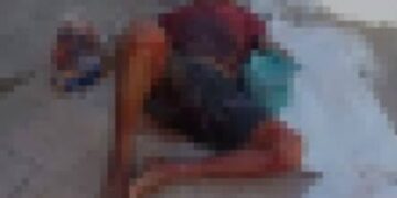 Homem tem mão decepada a facão durante discussão em Campo Maior