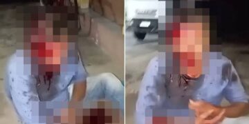 Homem é agredido com pedradas durante tentativa de assalto em Piracuruca