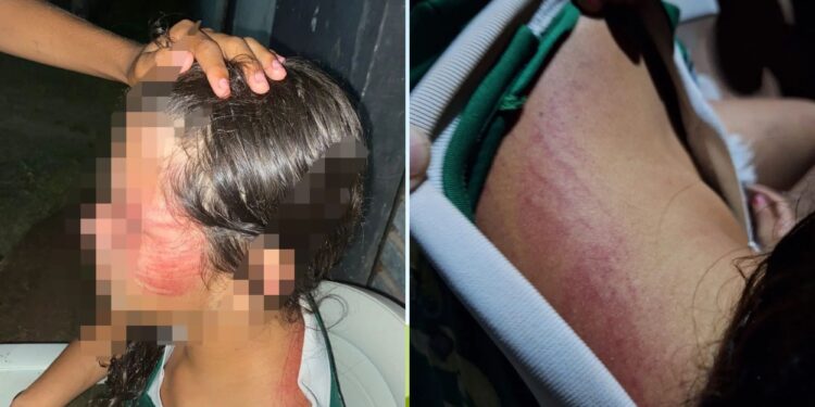 Criança de 12 anos é resgatada após sofrer maus-tratos no interior do Piauí