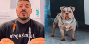 Influenciador acorda sem dedo após cachorro comer membro durante a noite