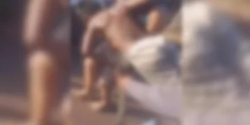 Criança cai sobre estaca de madeira ao tentar buscar pipa em árvore no Maranhão