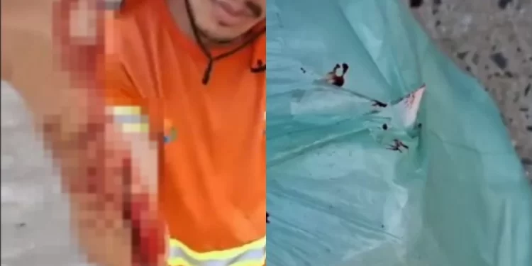Vidro descartado de forma irregular fere trabalhador da coleta de lixo em Teresina