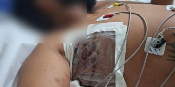 Homem conhecido como “Capilé” é esfaqueado em posto de combustível em José de Freitas