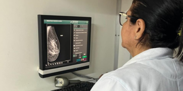 Prevenção do câncer de mama: veja como fazer mamografia gratuita pelo SUS no Piauí